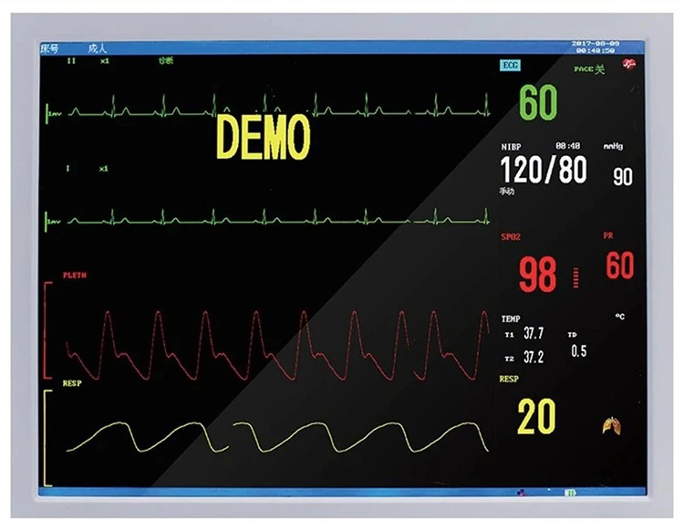 veterinary multiparameter monitor veterinary multiparameter monitor